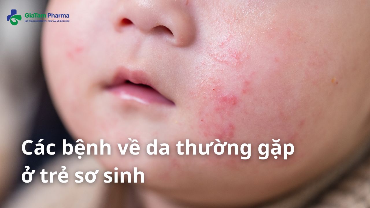 Các bệnh về da ở trẻ sơ sinh