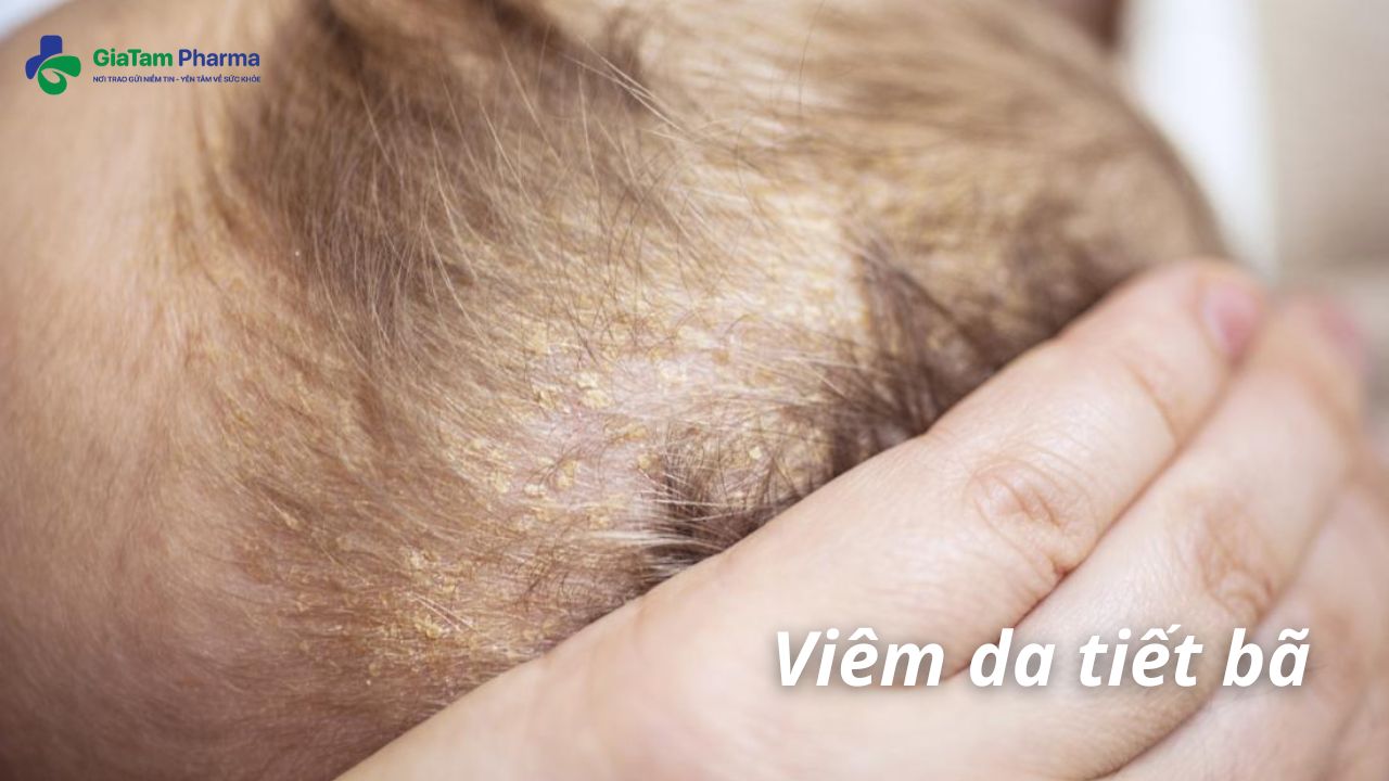 trẻ sơ sinh bị nổi mẩn đỏ